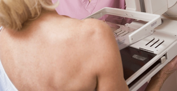 Mamógrafo capaz de detectar el cáncer con dos años de antelación