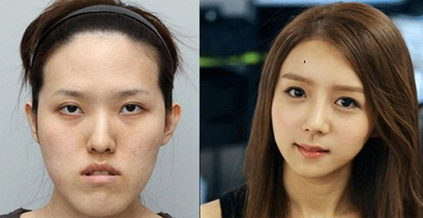 Cirugías faciales sorprendentes